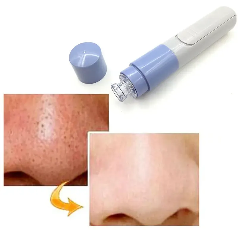 Вакуумний очищувач пор Pore Cleaner