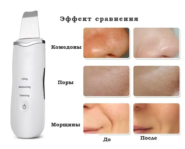 Апарат для ультразвукового чищення обличчя Ultrasonic Shovel