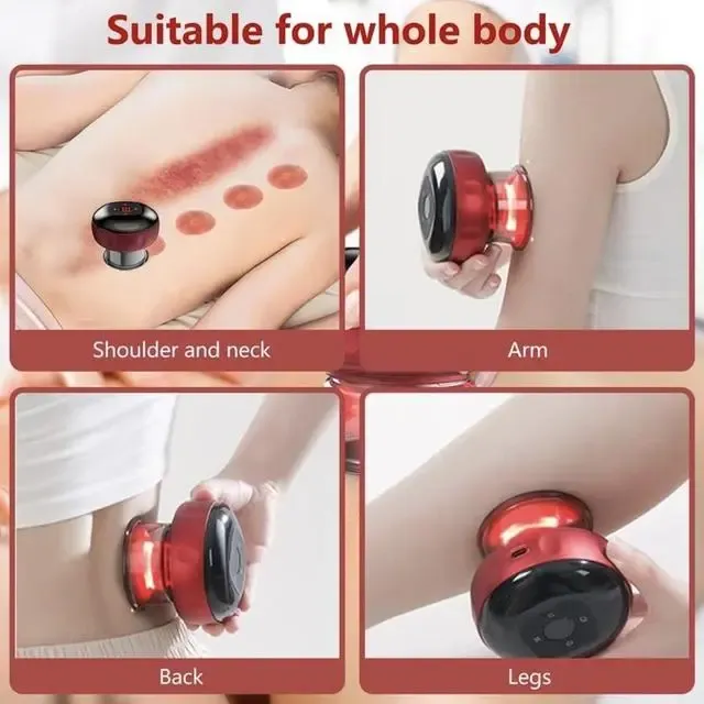 Електричний вакуумний масаж | Масажер для тіла Масажер з ефектом банок