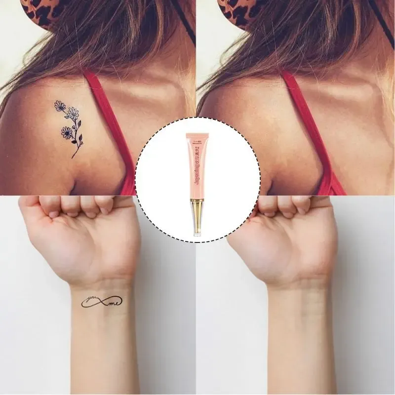 Крем для видалення небажаних татуювань