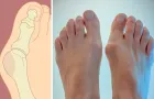Магнітна вальгусна шина RELAX FOOT (Magnet Fix) Магнітний коректор стопи