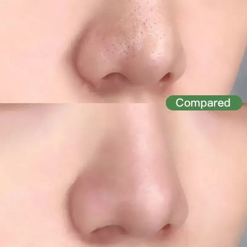 Маска для обличчя з маслом зеленого чаю проти чорних точок акне очищаюча Green Tea крем зволожуючий